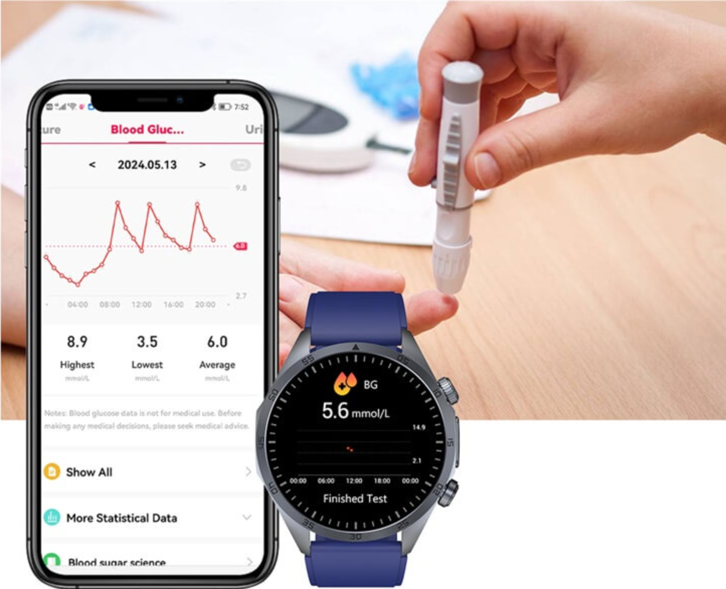 Blood glucose trend tracking on the REXQU CoreX Pro