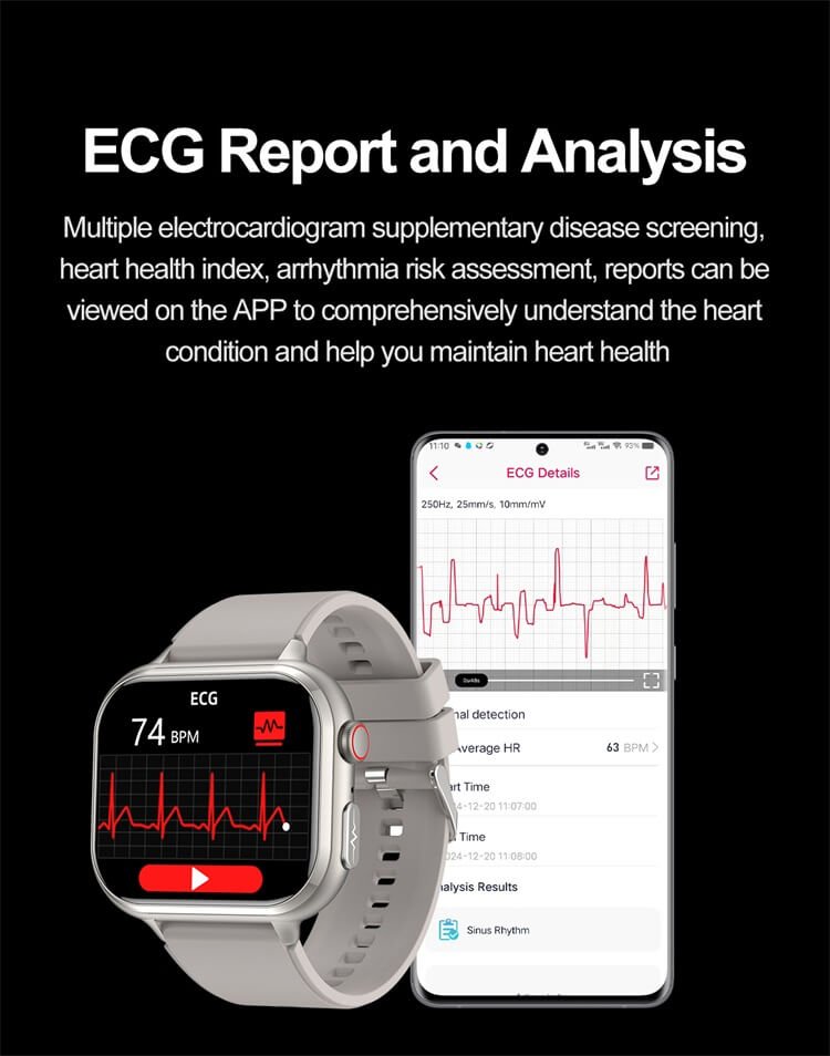 ECG report and analysis on the REXQU IntelliFit