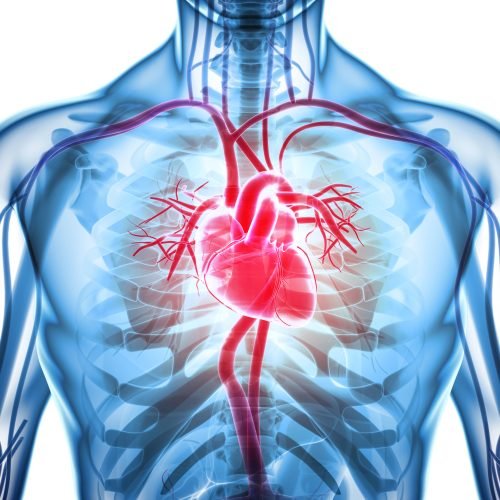 Heart xray